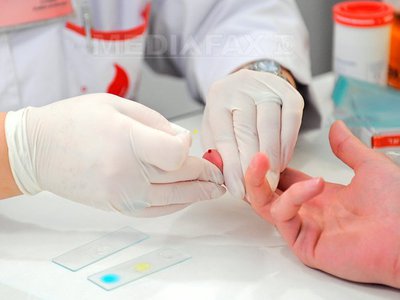 virus transmis pe cale sexuală test sangvin