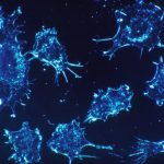 [VIDEO] Tratamentul „complet” pentru cancer. Un grup de cercetători israelieni susține că l-a găsit
