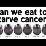 Putem să mâncăm astfel încât să infometăm cancerul?