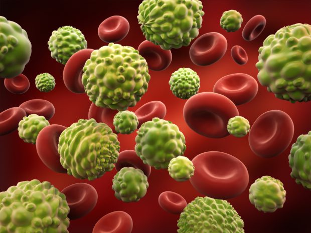 celule sanguine leucemia acută