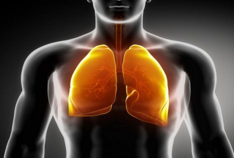 plamani, cancerul pulmonar